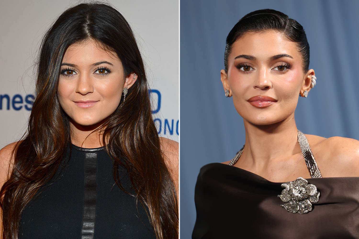 Kylie Jenners Eingriffe: Fakten & Gerüchte